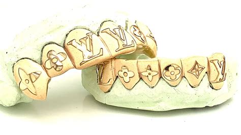 louis vuitton grillz|6 Top 6 Bottom Laser Diamond Dusted Louis Vuitton .